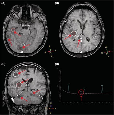 the villages brain mri with contrast|MRI in The Villages, FL starting at $375 .